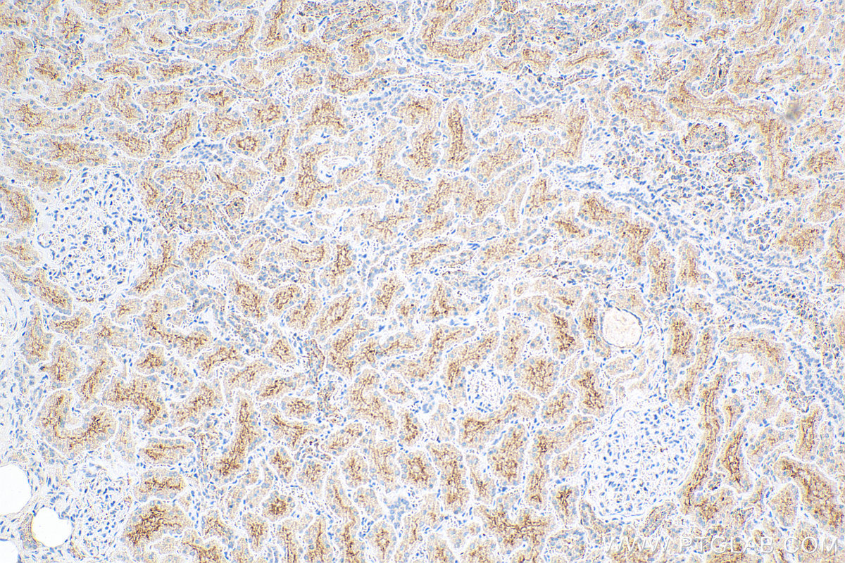 IHC staining of human kidney using 12518-1-AP (same clone as 12518-1-PBS)