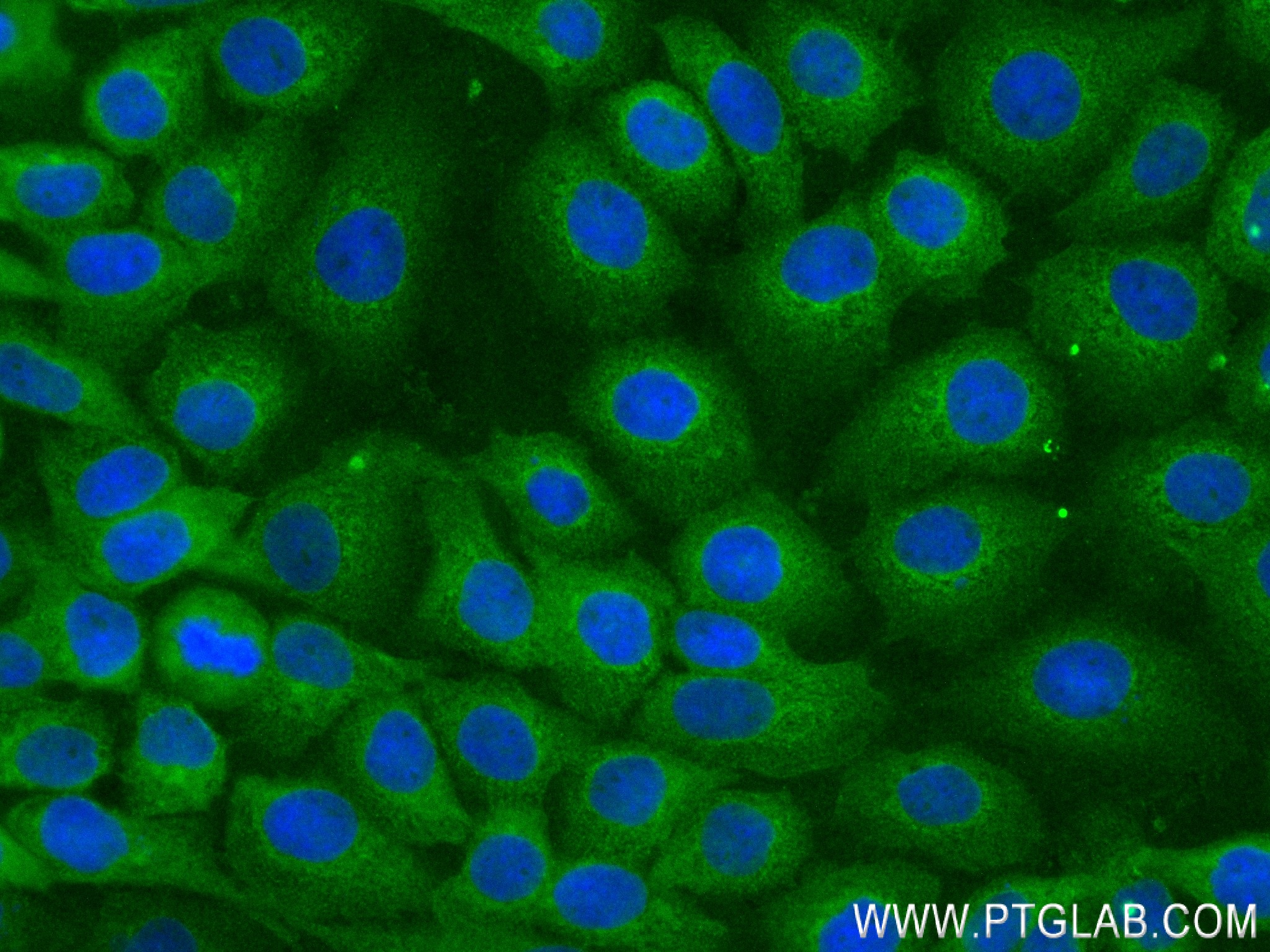 IF Staining of A431 using 83958-3-RR