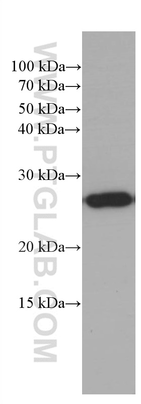 WB analysis of fetal human brain using 66438-1-Ig (same clone as 66438-1-PBS)