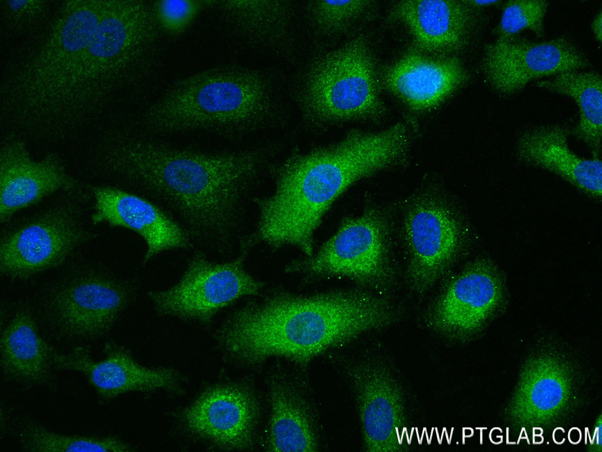 IF Staining of A549 using 83589-5-RR (same clone as 83589-5-PBS)