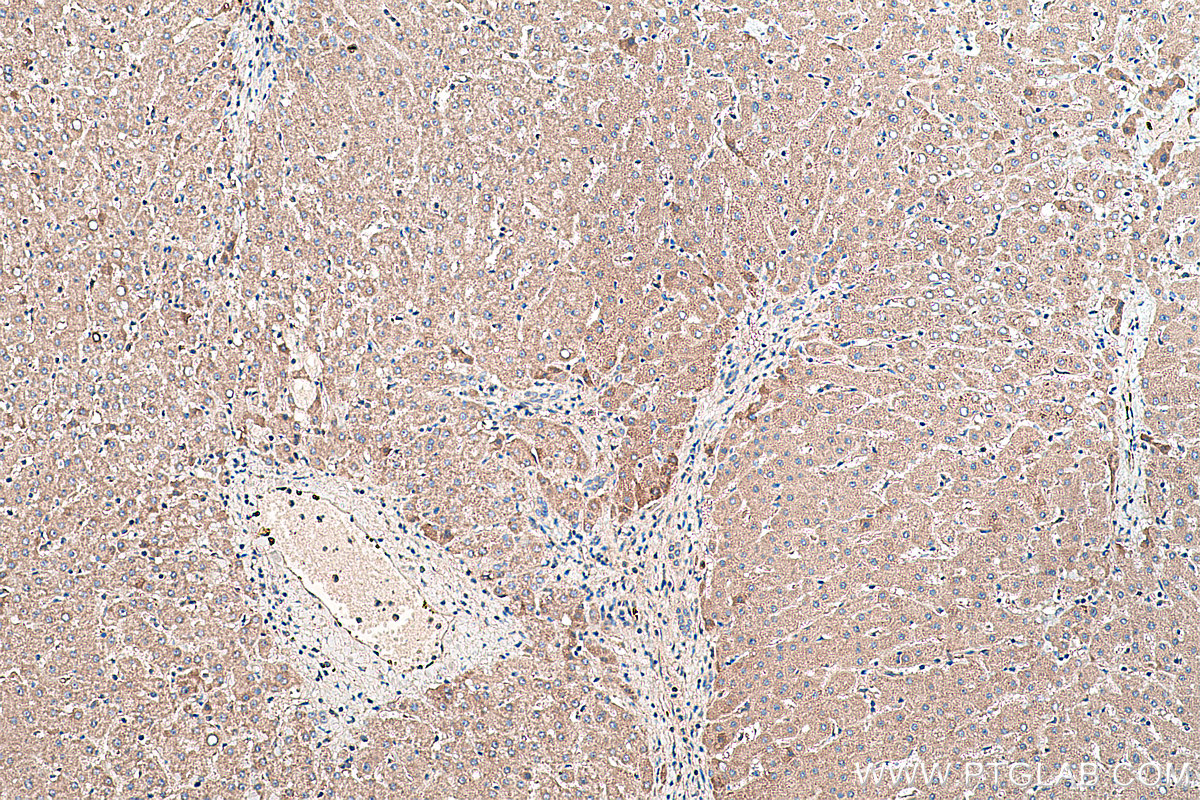 IHC staining of human liver using 26045-1-AP