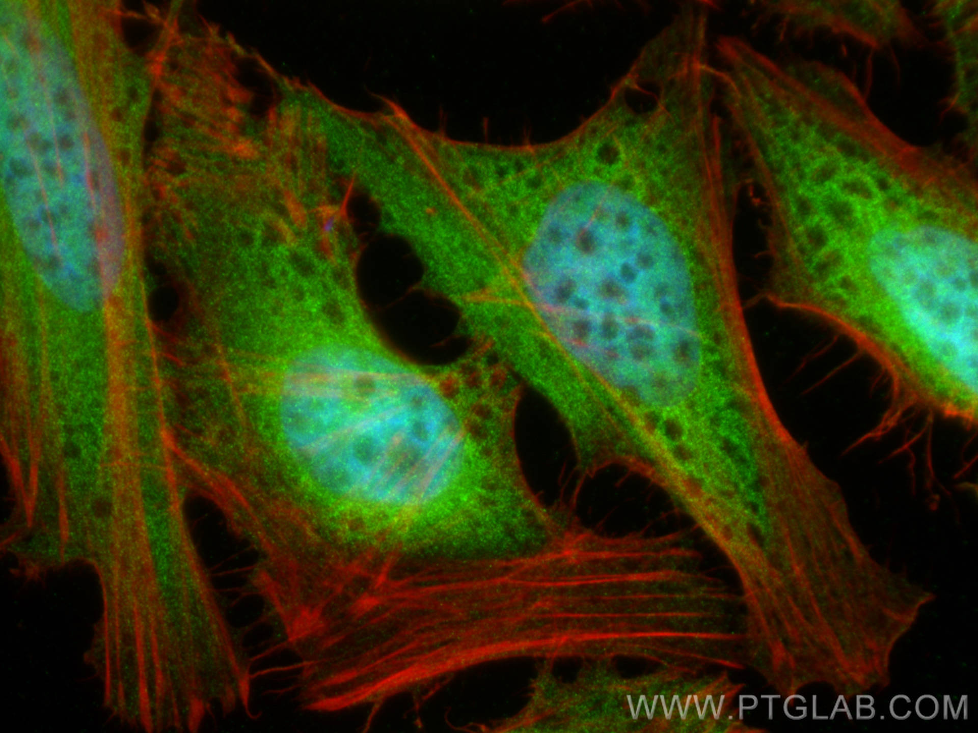 IF Staining of HeLa using 14412-1-AP