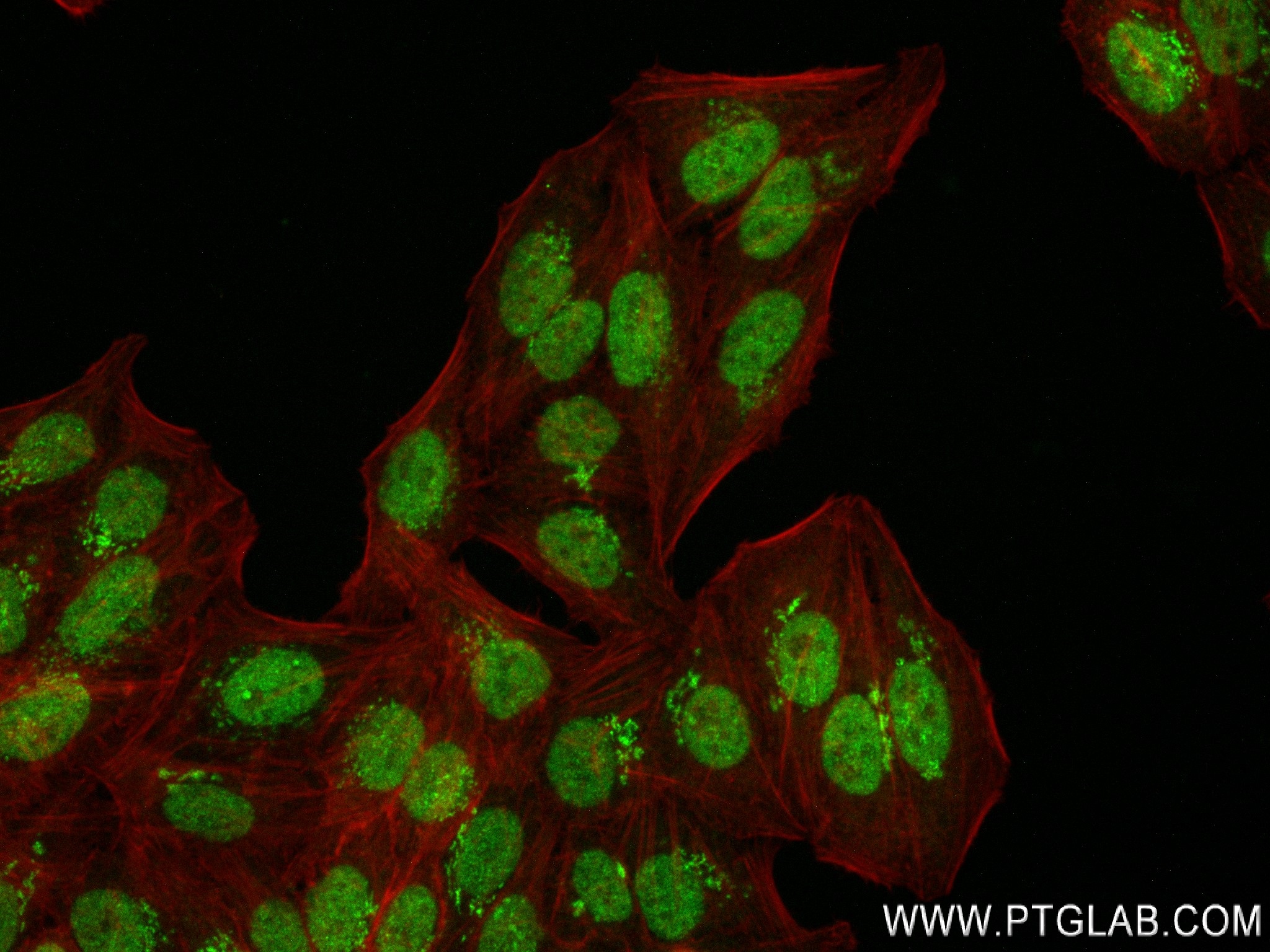 IF Staining of HepG2 using 84030-5-RR (same clone as 84030-5-PBS)