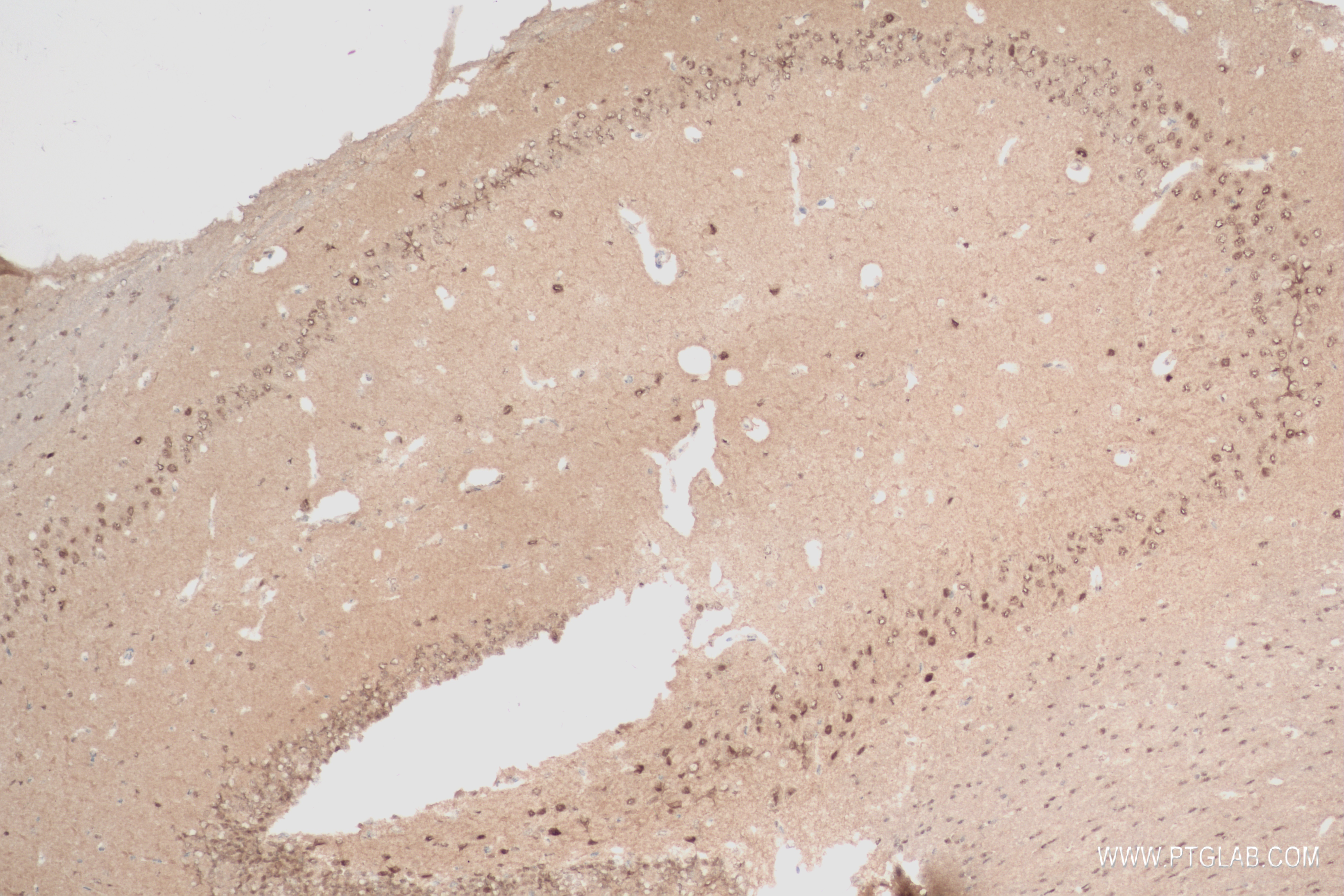 IHC staining of mouse brain using 84030-5-RR