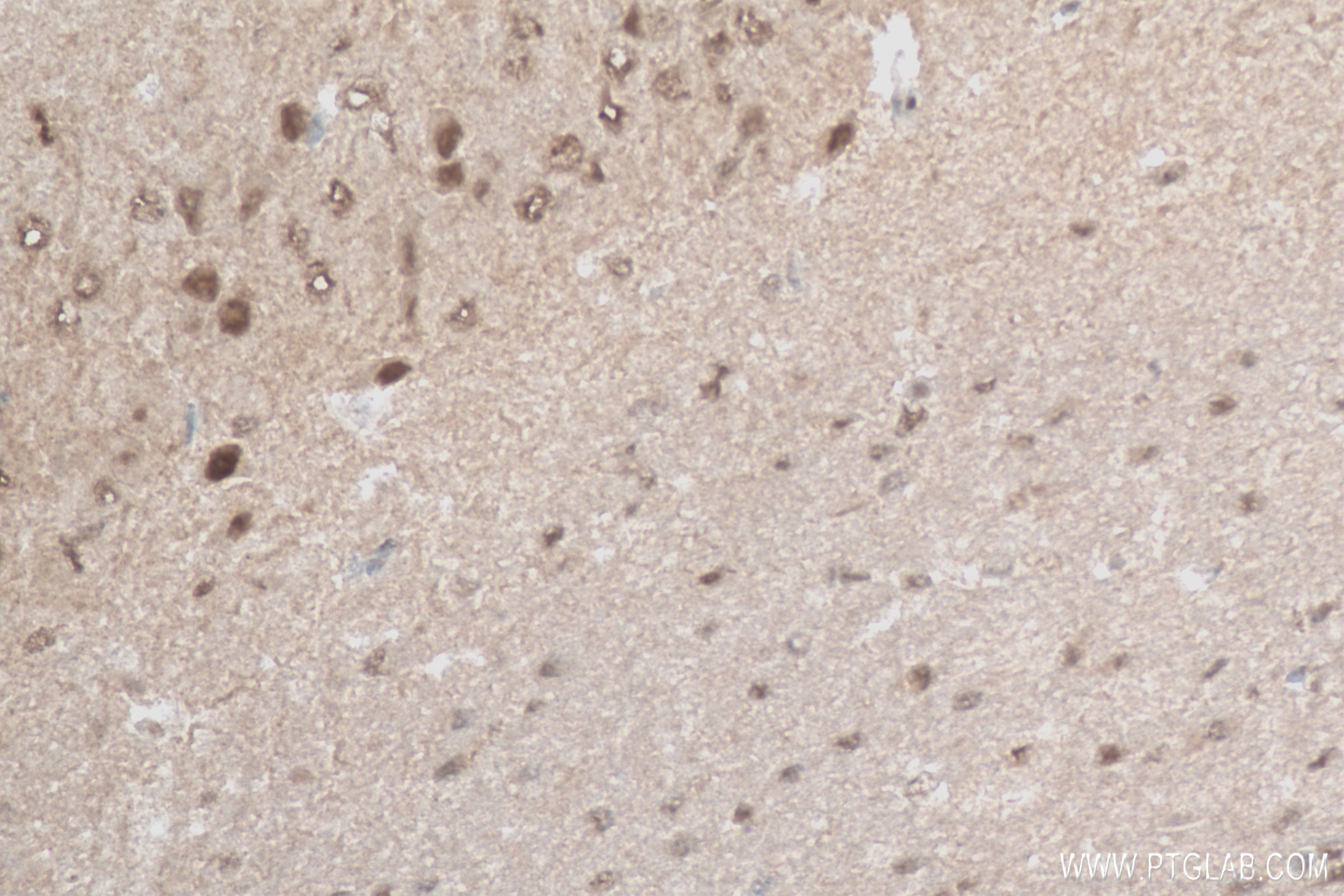 IHC staining of mouse brain using 84030-5-RR