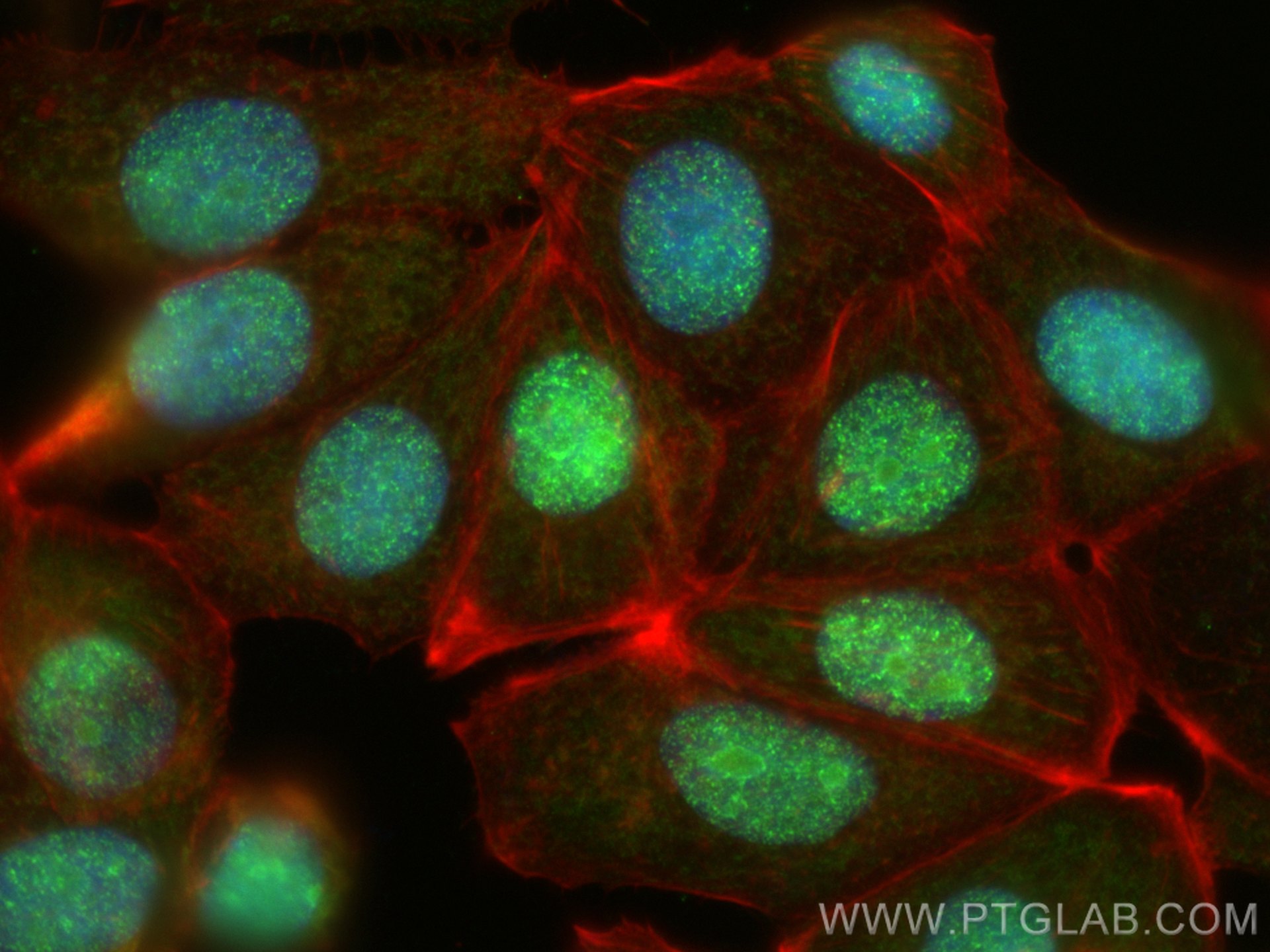 IF Staining of MCF-7 using 30135-1-AP