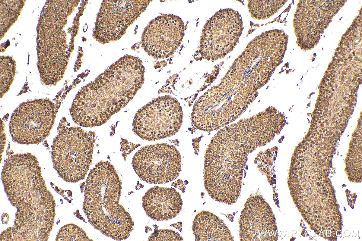 IHC staining of mouse testis using 30135-1-AP