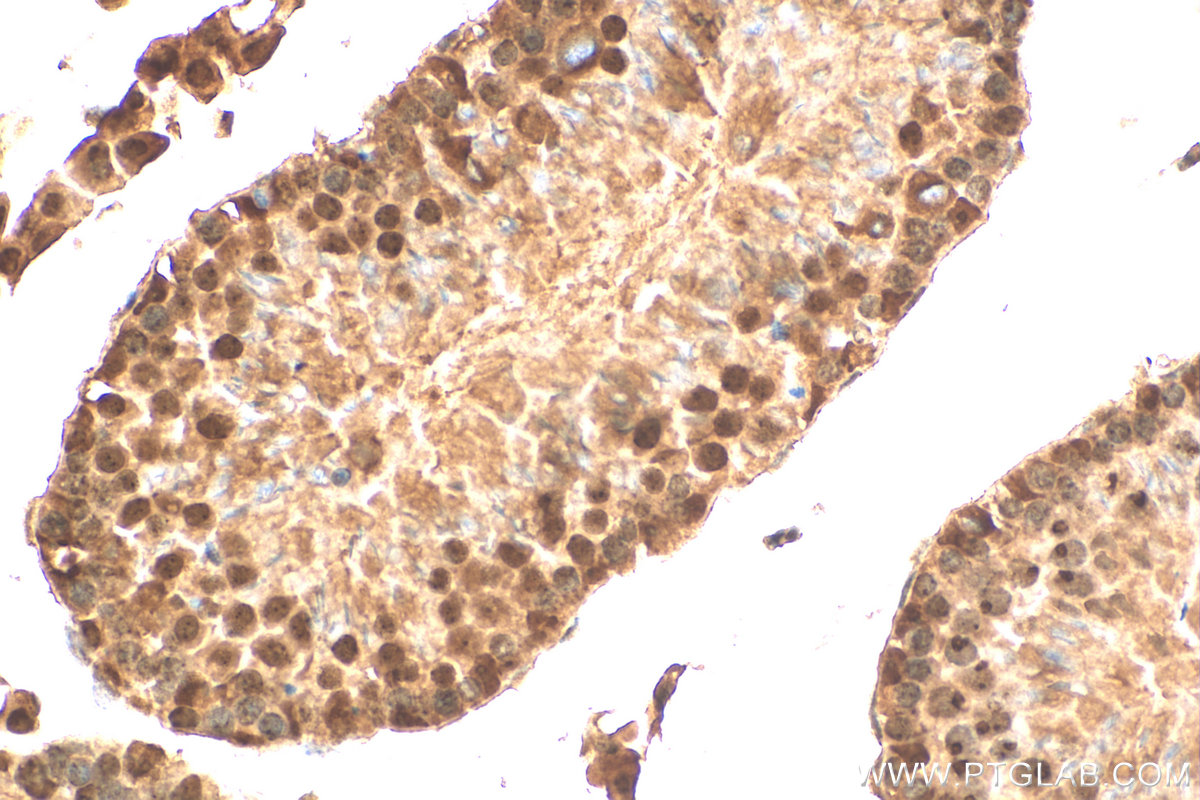 IHC staining of mouse testis using 30135-1-AP