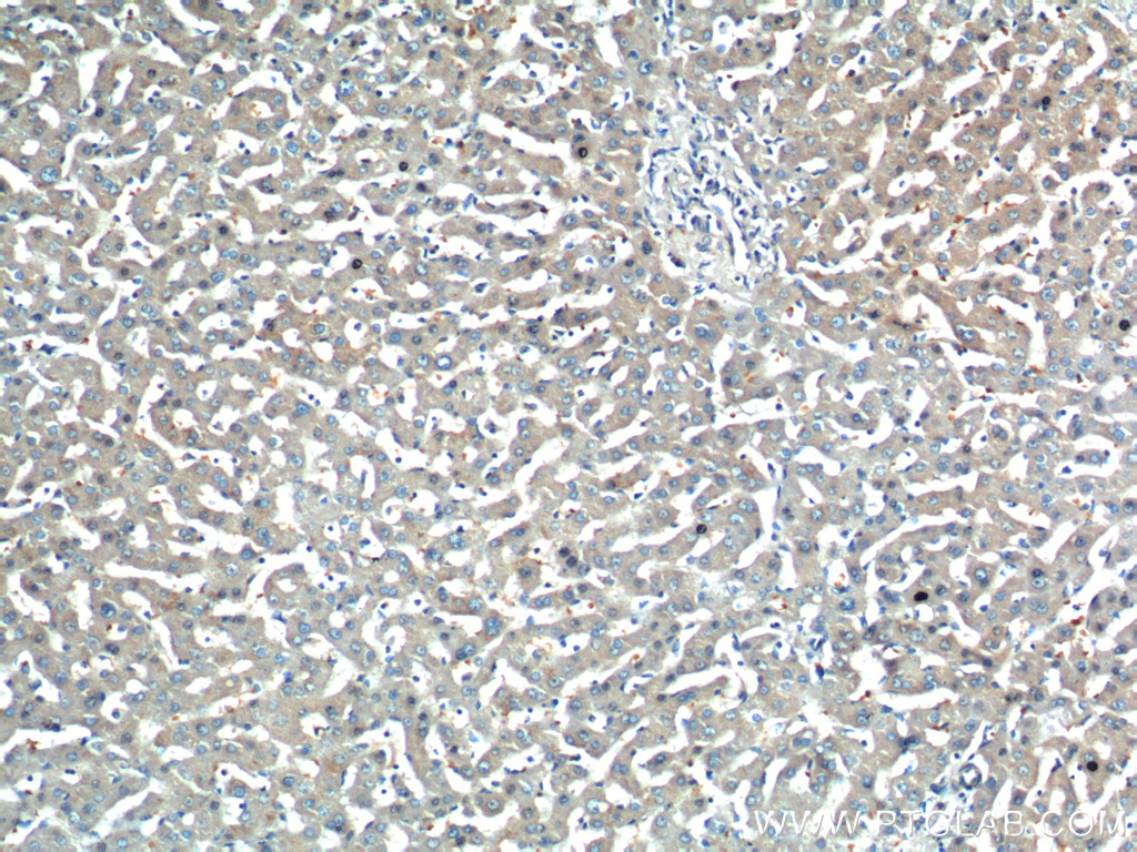 IHC staining of human liver using 25916-1-AP