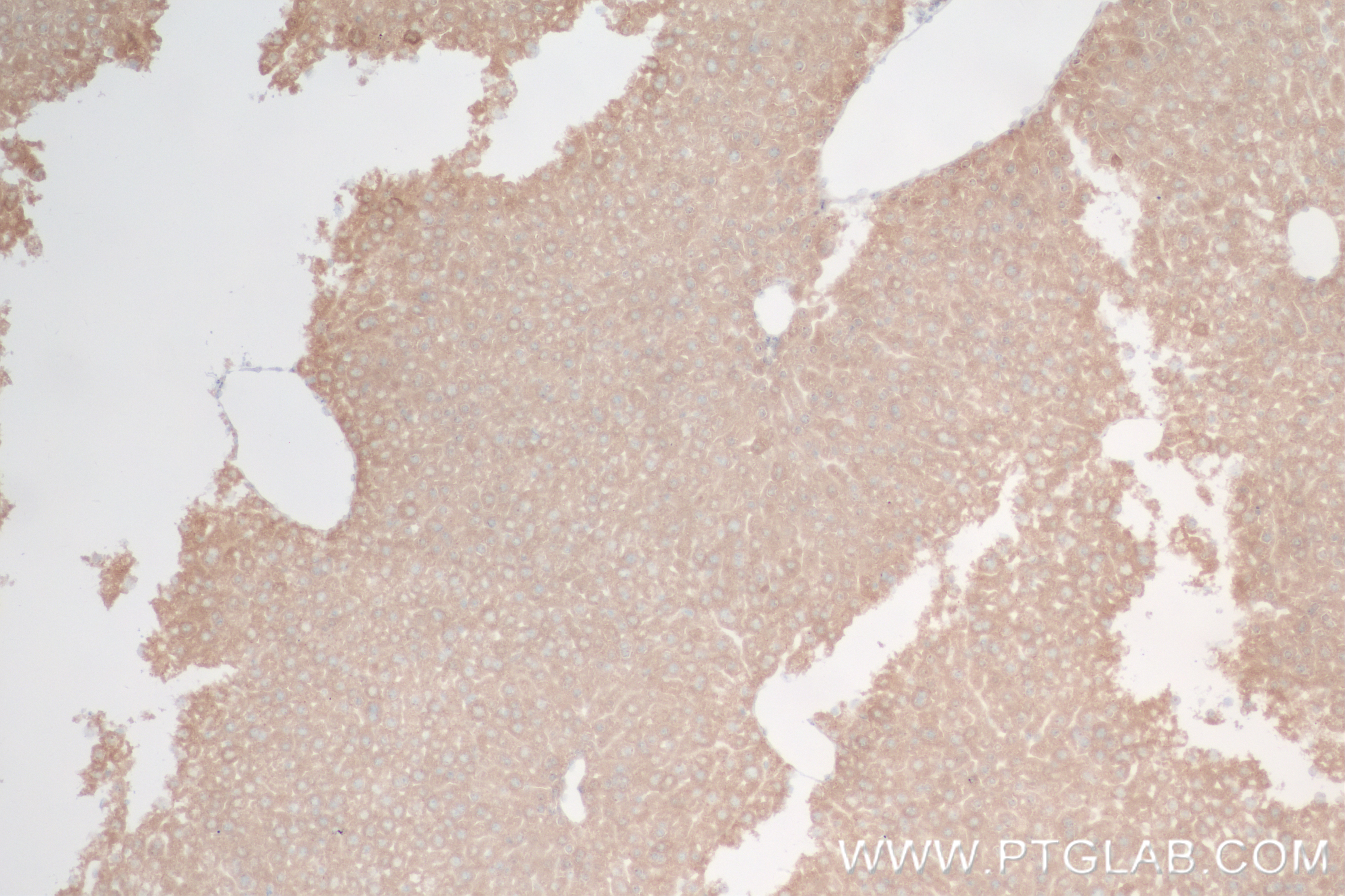 IHC staining of mouse liver using 85099-1-RR (same clone as 85099-1-PBS)