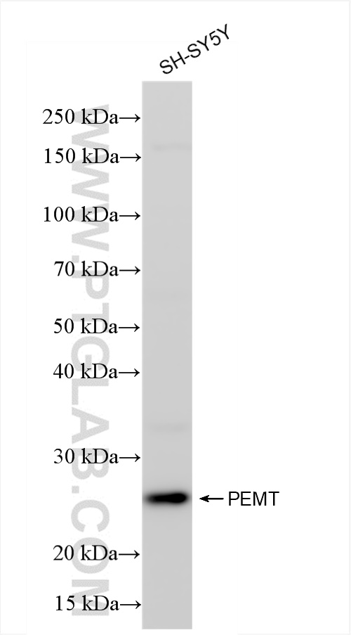 WB analysis of SH-SY5Y using 85099-1-RR (same clone as 85099-1-PBS)