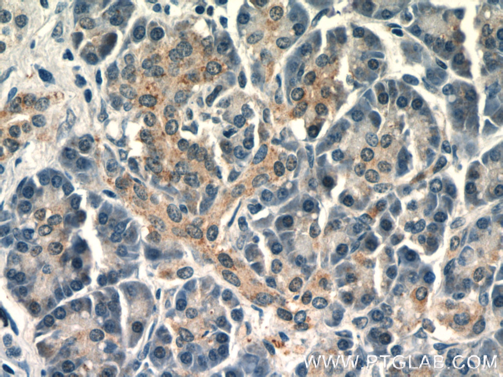 IHC staining of human pancreas using 18793-1-AP