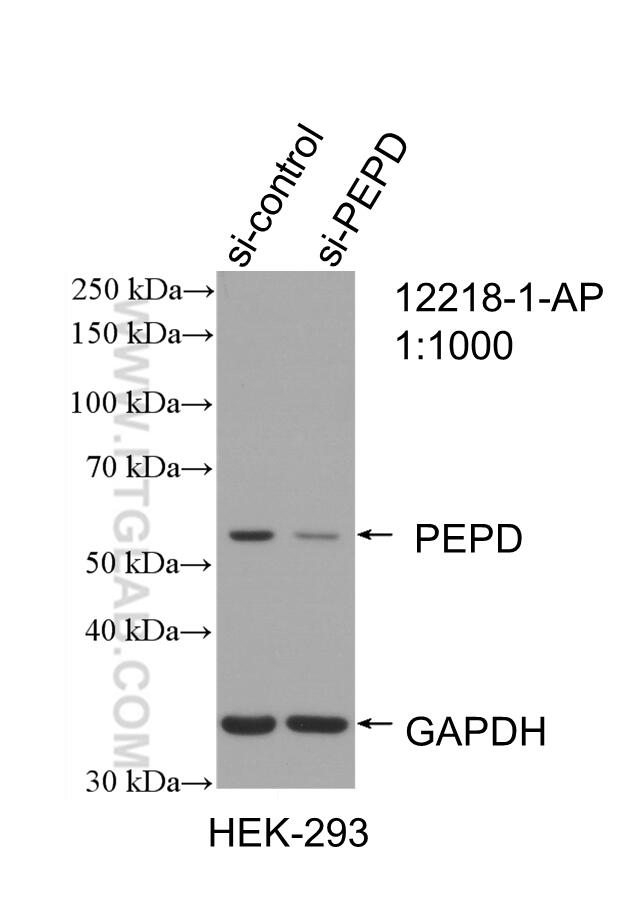 WB analysis of HEK-293 using 12218-1-AP