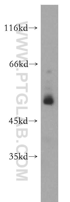 WB analysis of A549 using 13463-1-AP