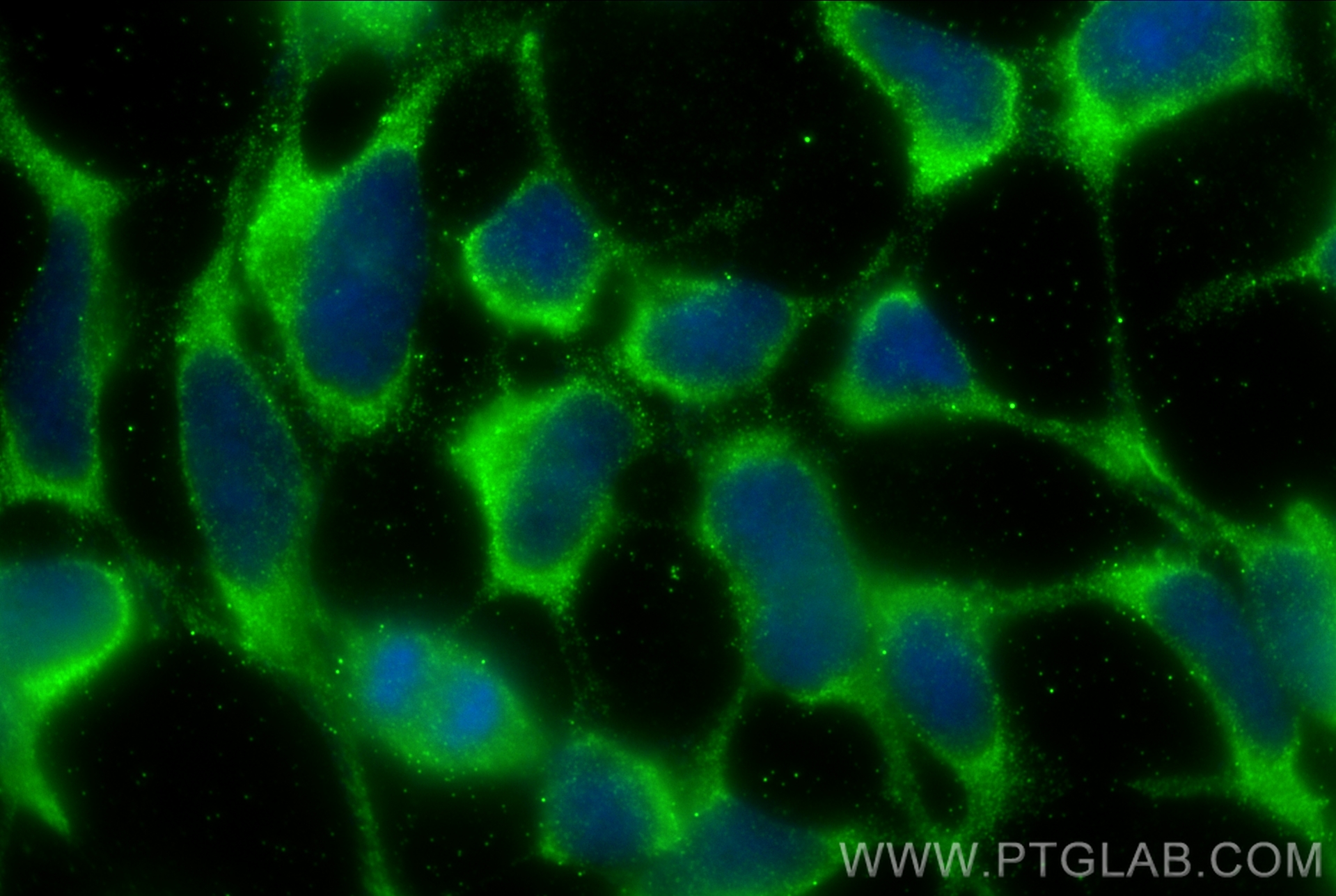 IF Staining of HEK-293 using 20582-1-AP