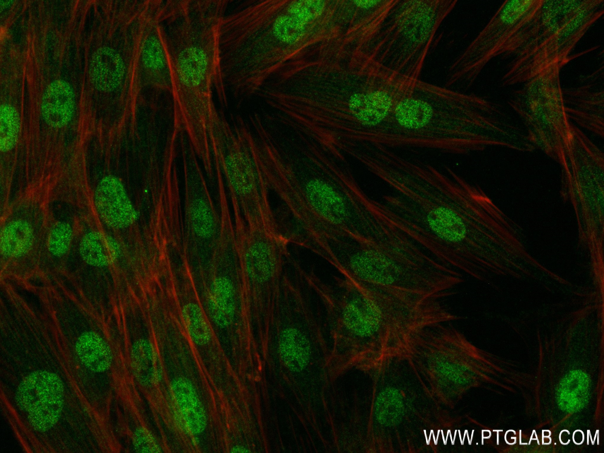 IF Staining of H9C2 using 84425-5-RR (same clone as 84425-5-PBS)