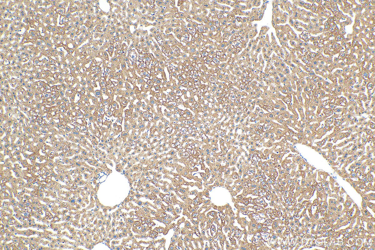 IHC staining of mouse liver using Biotin-10594