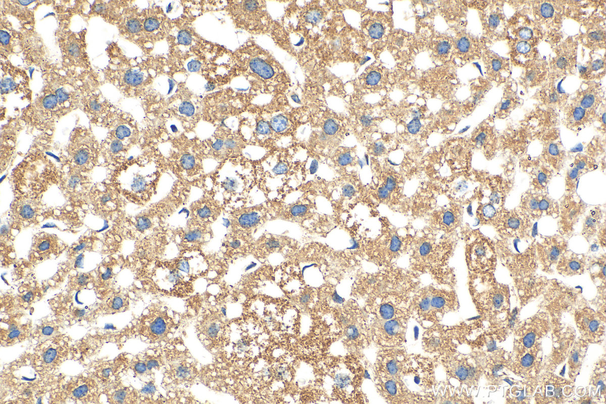 IHC staining of mouse liver using Biotin-10594