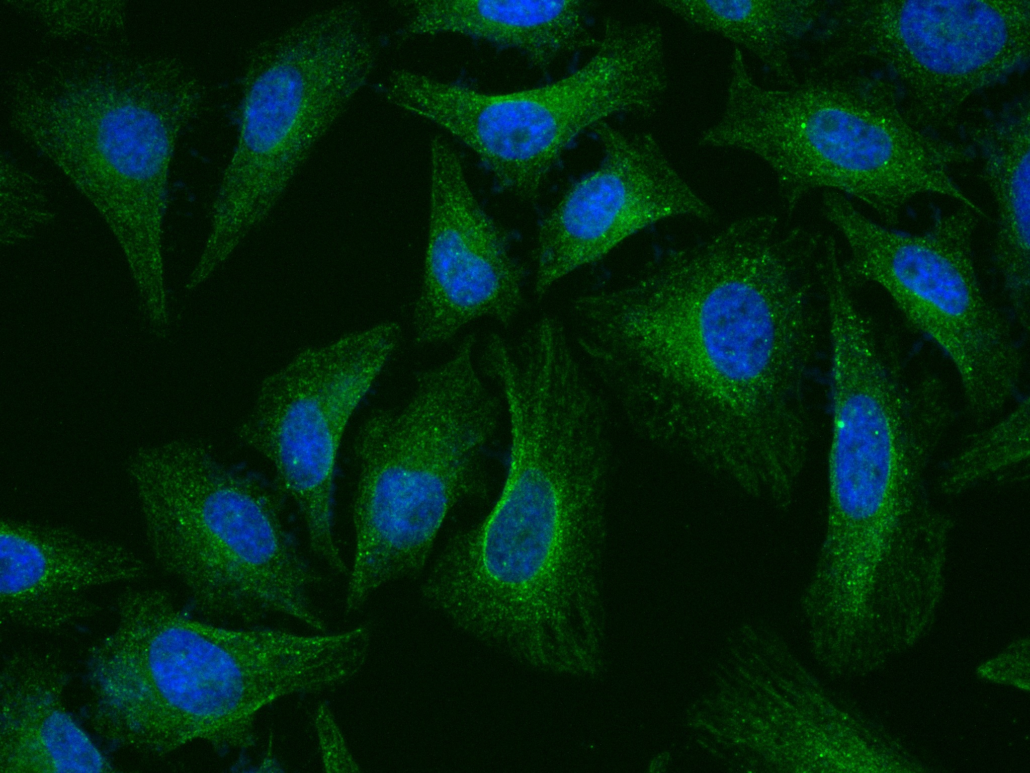 IF Staining of HeLa using 80196-1-RR