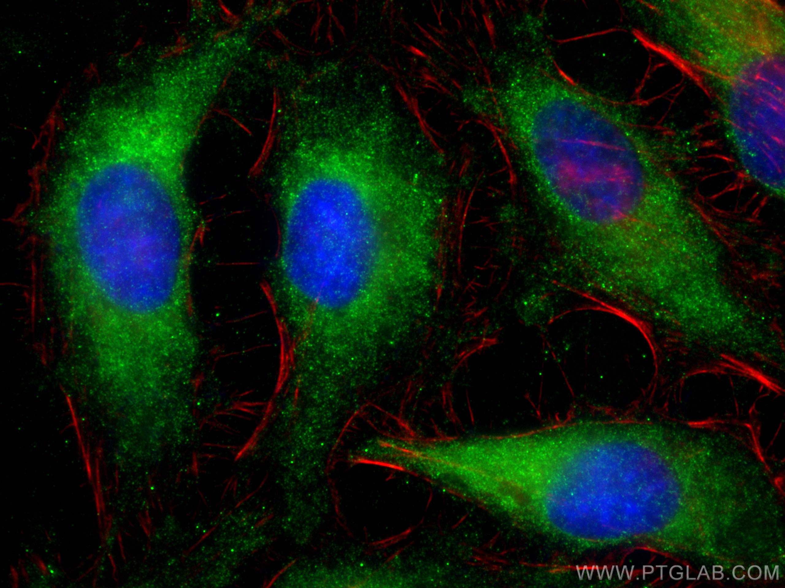 IF Staining of HeLa using 68555-1-Ig