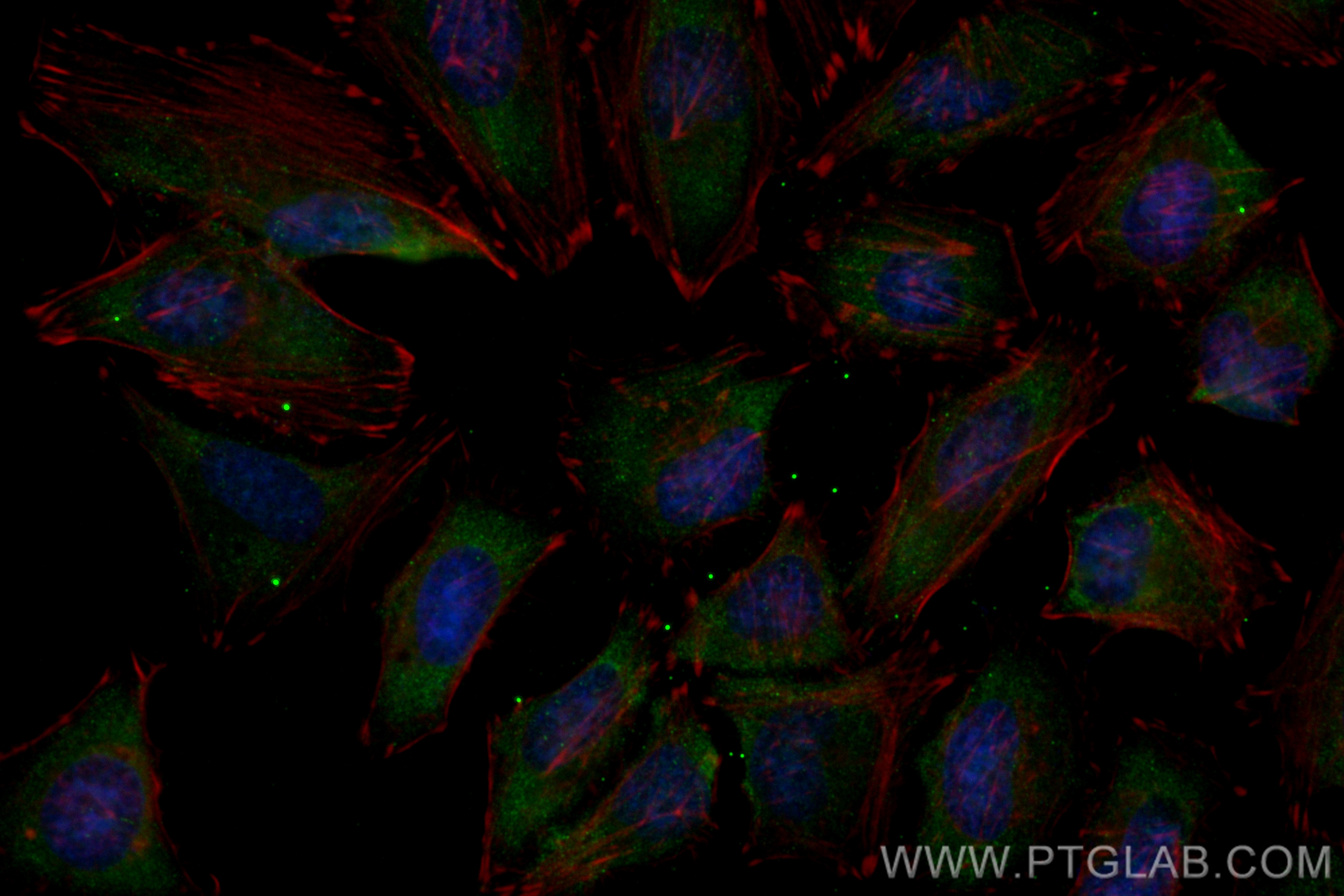 IF Staining of HeLa using CL488-68555