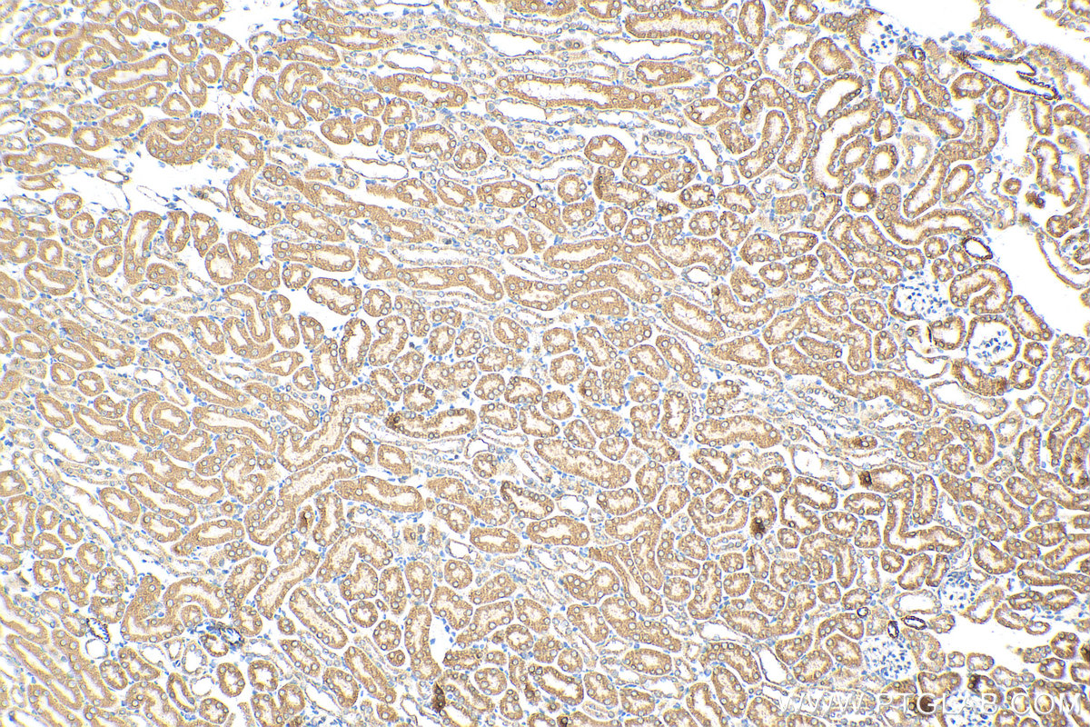 IHC staining of mouse kidney using 30424-1-AP