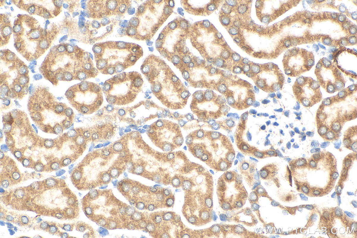 IHC staining of mouse kidney using 30424-1-AP