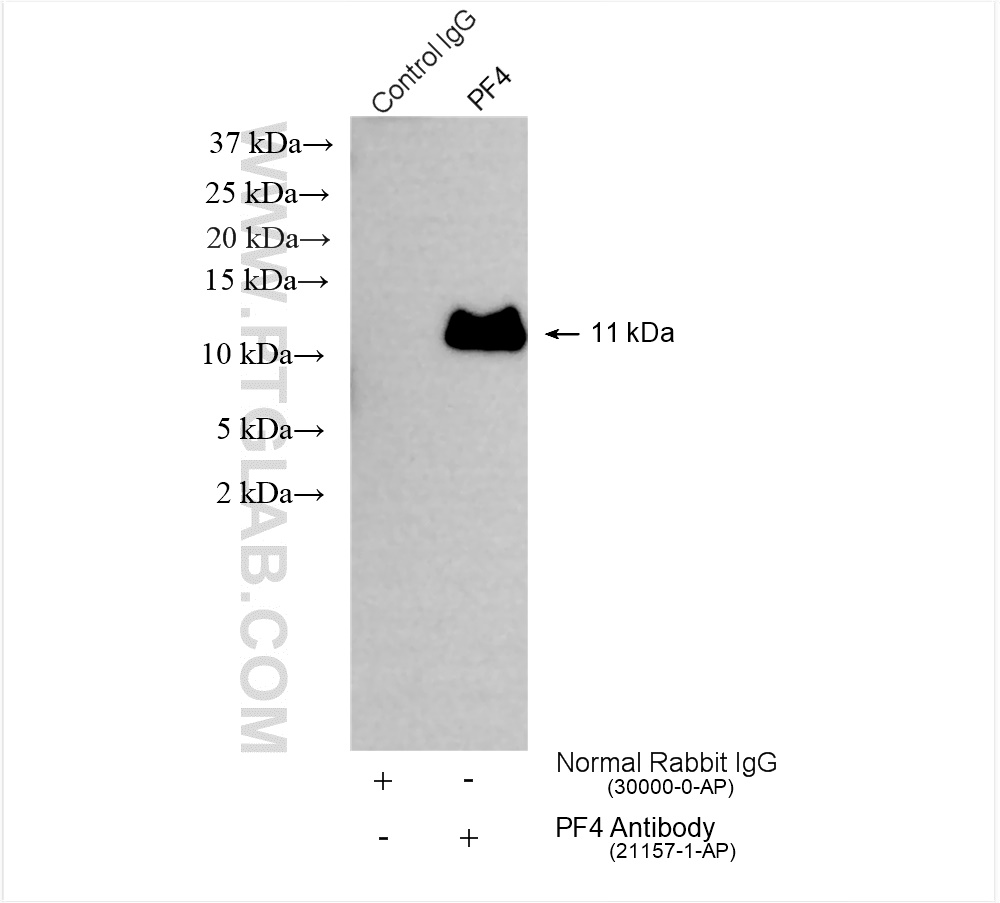 IP experiment of mouse serum using 21157-1-AP