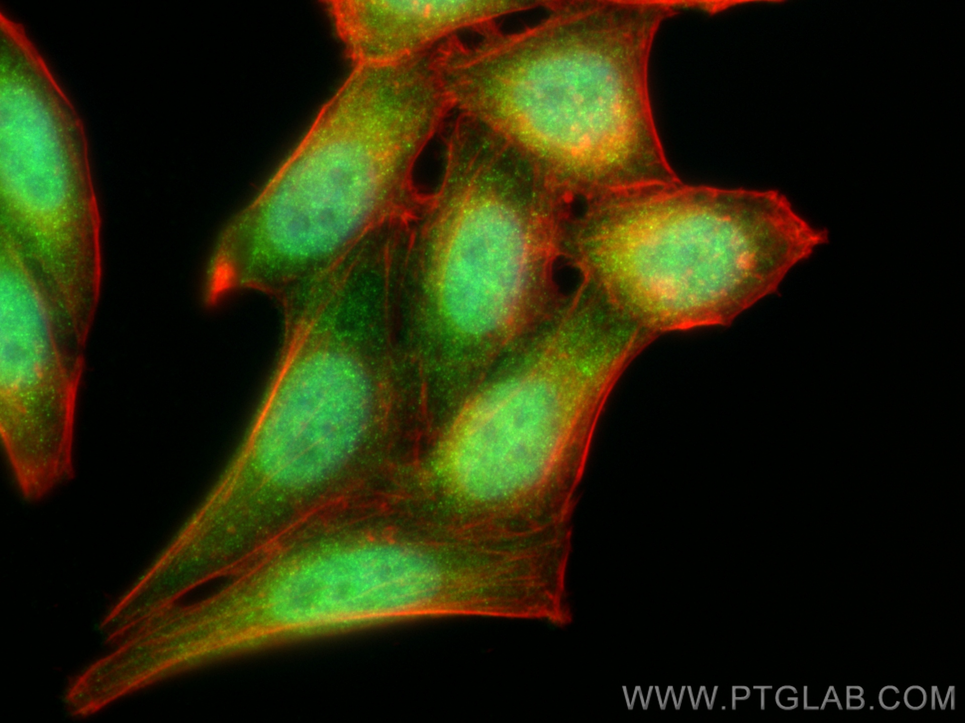 IF Staining of HepG2 using 15078-1-AP