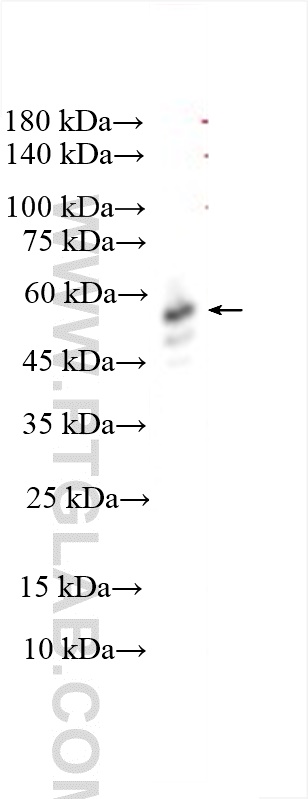 WB analysis of mouse retina using 17838-1-AP