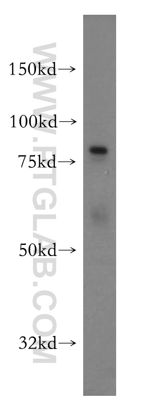 WB analysis of HeLa using 15652-1-AP