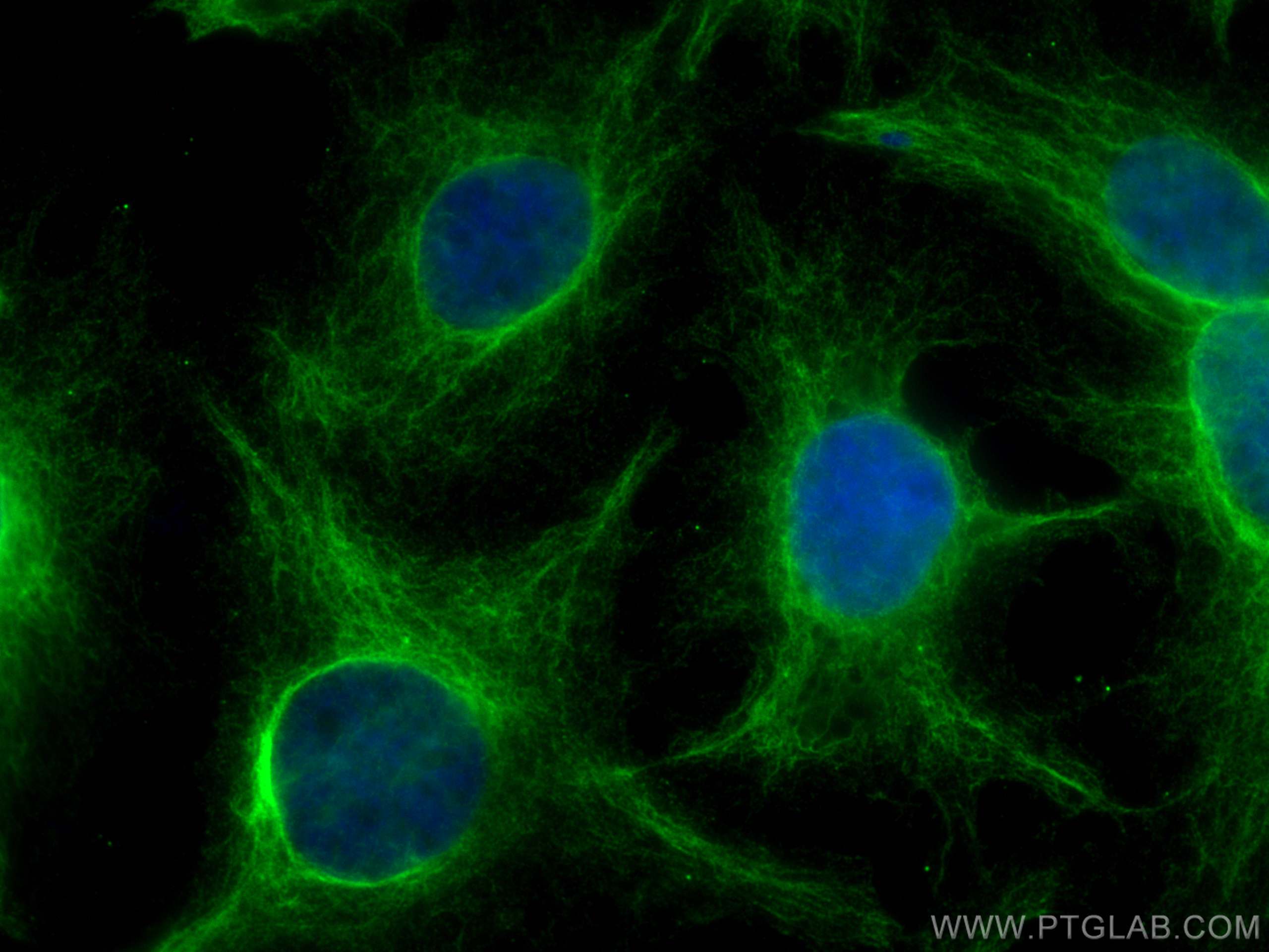 IF Staining of HuH-7 using 68385-1-Ig (same clone as 68385-1-PBS)