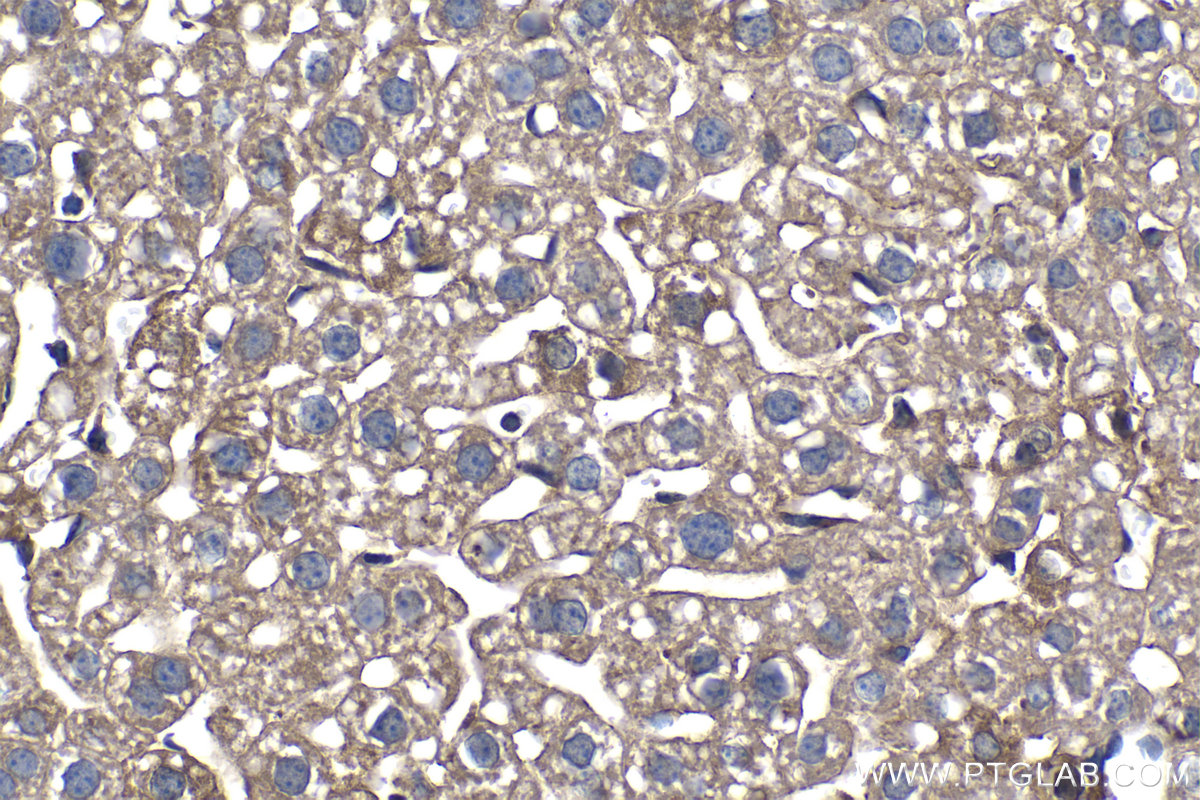 IHC staining of mouse liver using 68385-1-Ig (same clone as 68385-1-PBS)