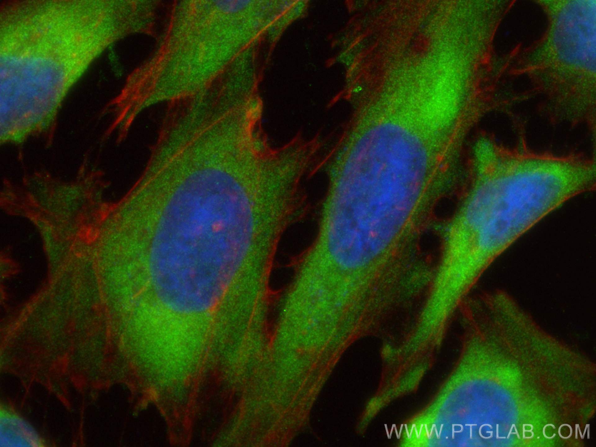 IF Staining of HeLa using 55028-1-AP