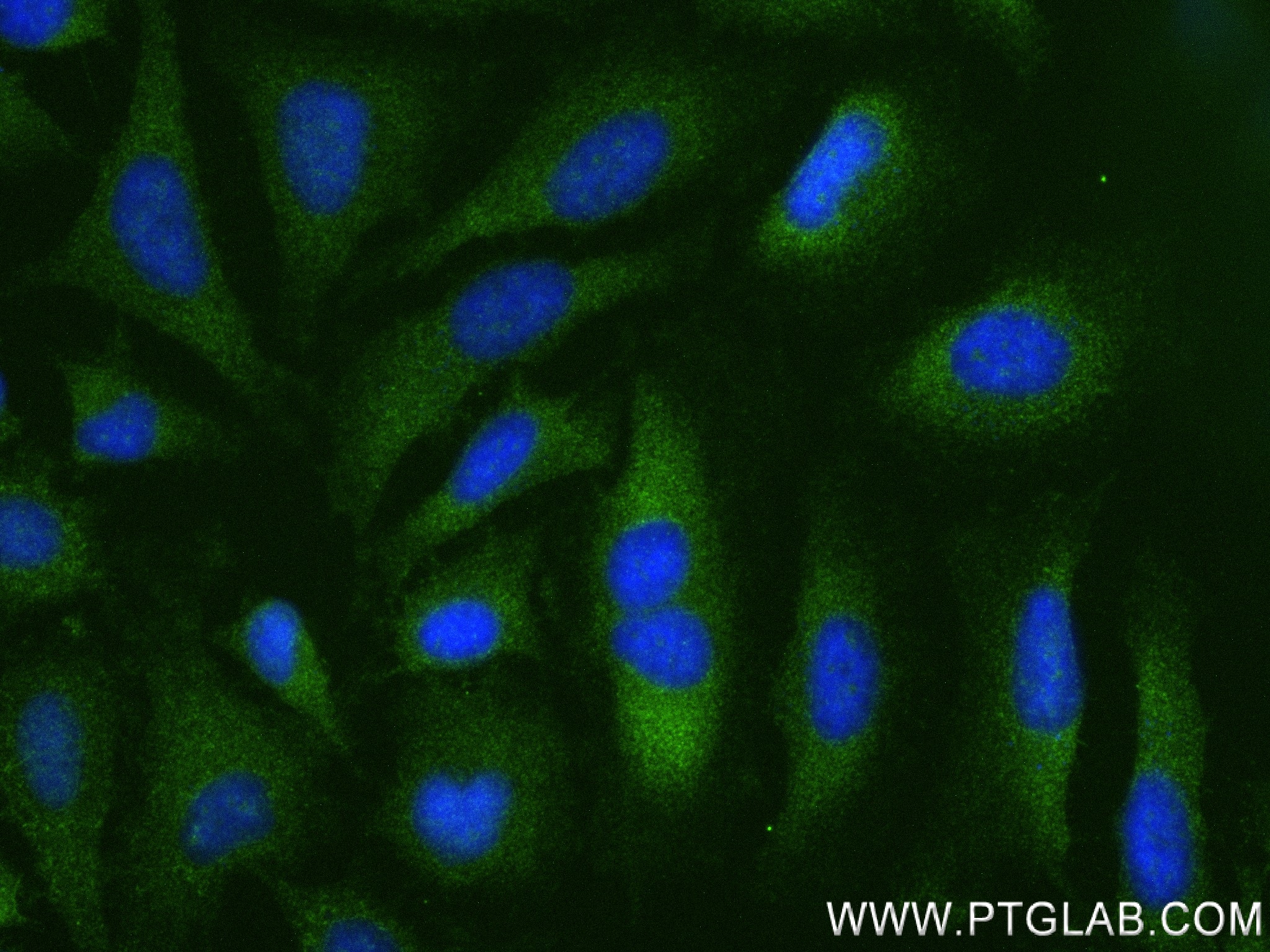 IF Staining of HeLa using 84281-5-RR