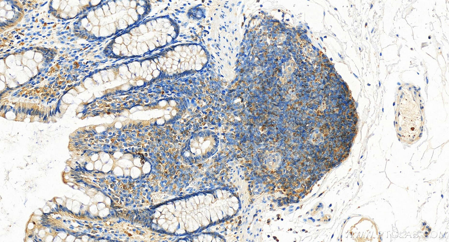 IHC staining of human normal colon using 11680-1-AP