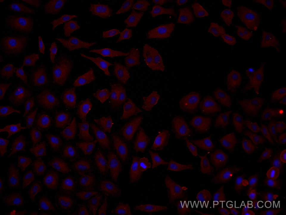 IF Staining of HeLa using 60094-2-Ig