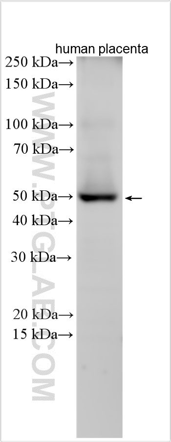 CDK15