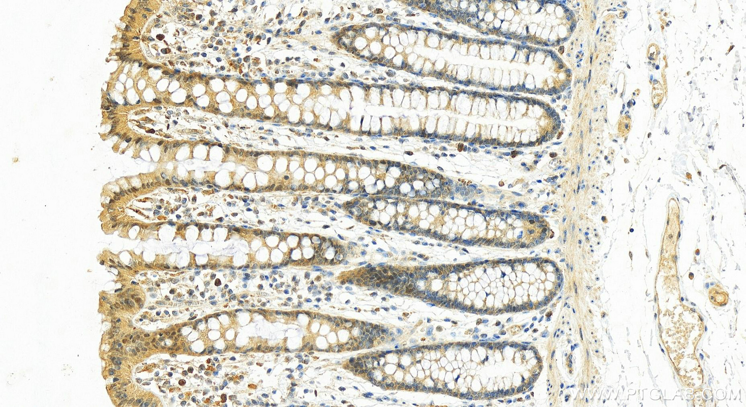 IHC staining of human normal colon using 16126-1-AP