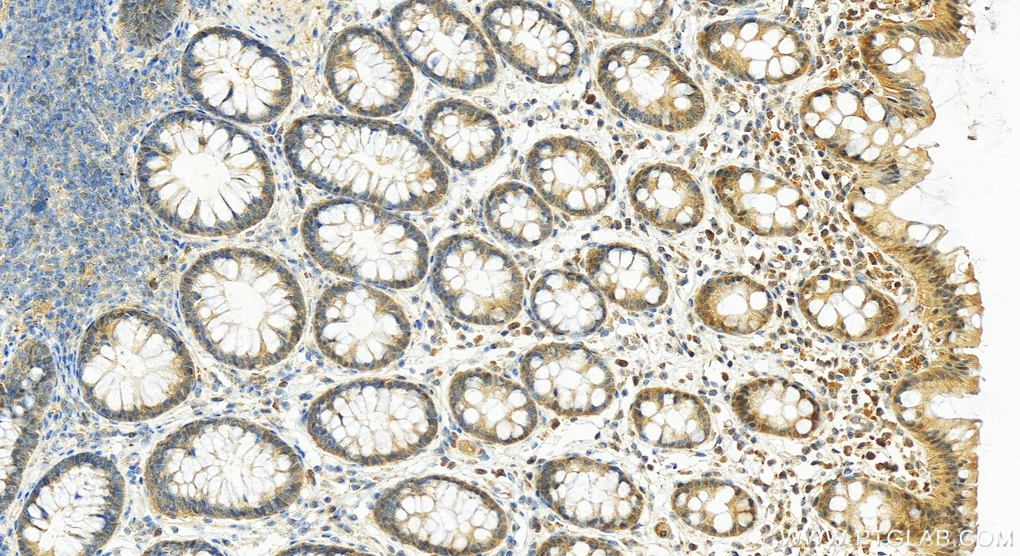 IHC staining of human normal colon using 16126-1-AP