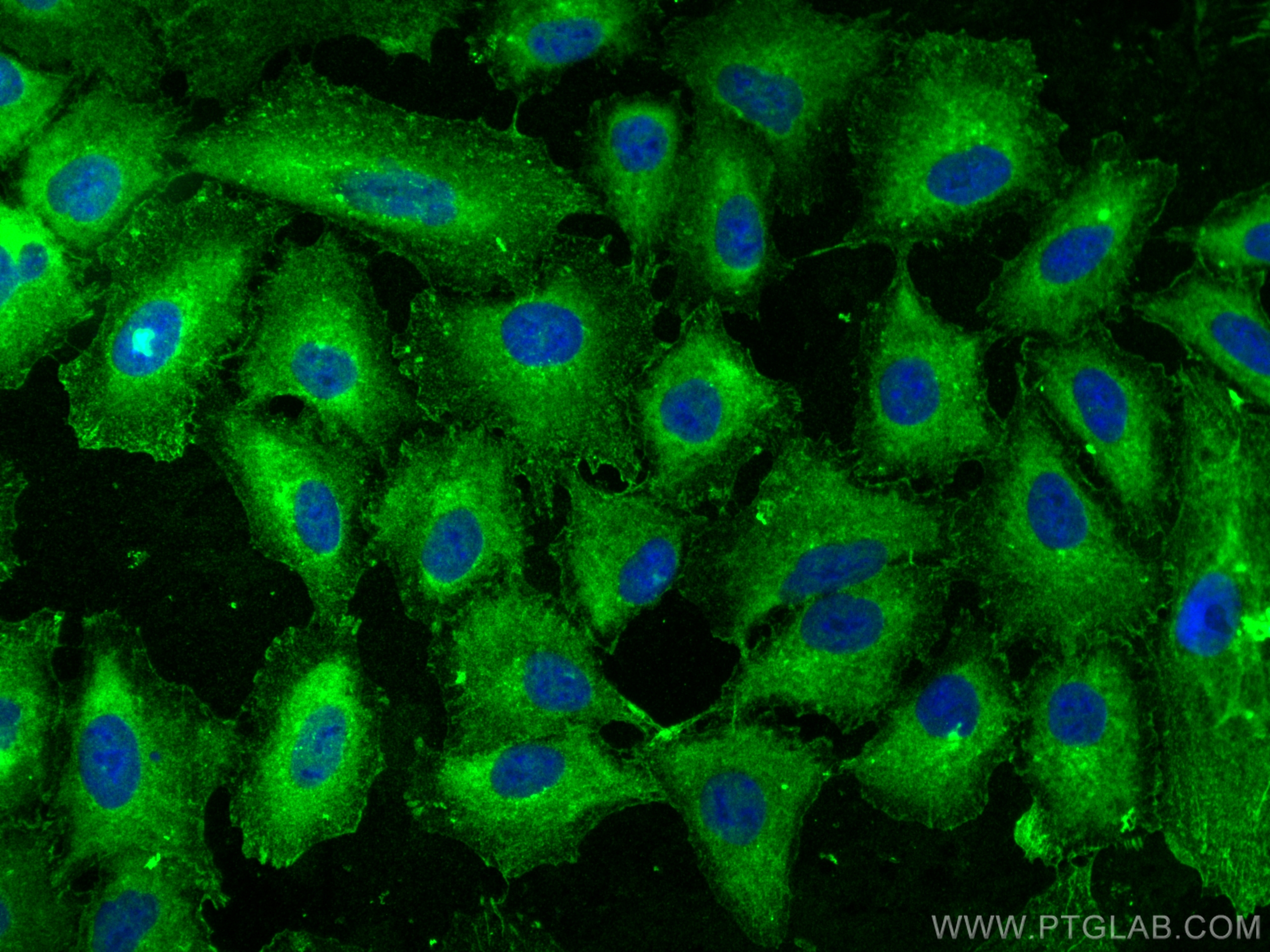 IF Staining of A549 using 16126-1-AP