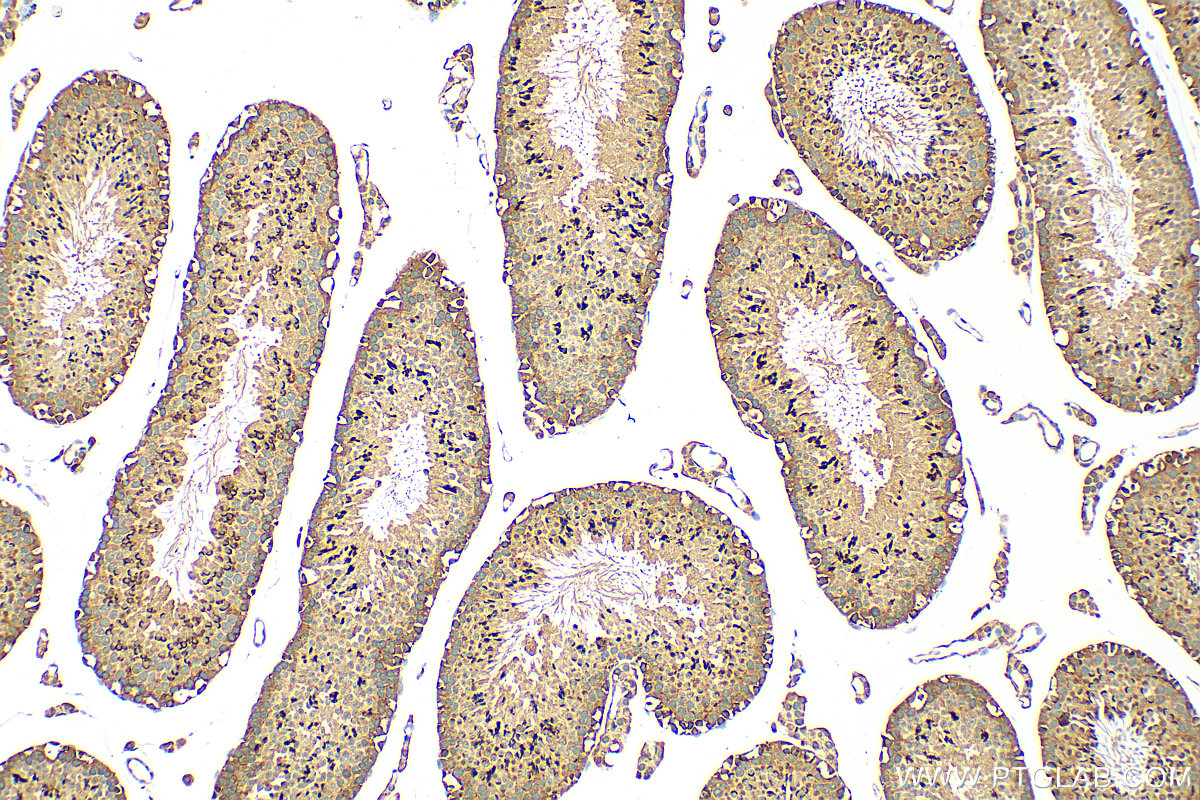 IHC staining of mouse testis using 25539-1-AP