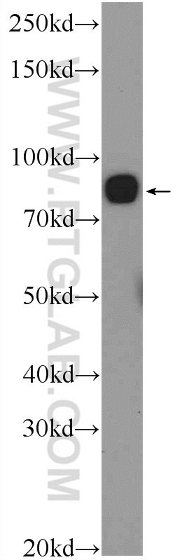 WB analysis of HeLa using 25539-1-AP