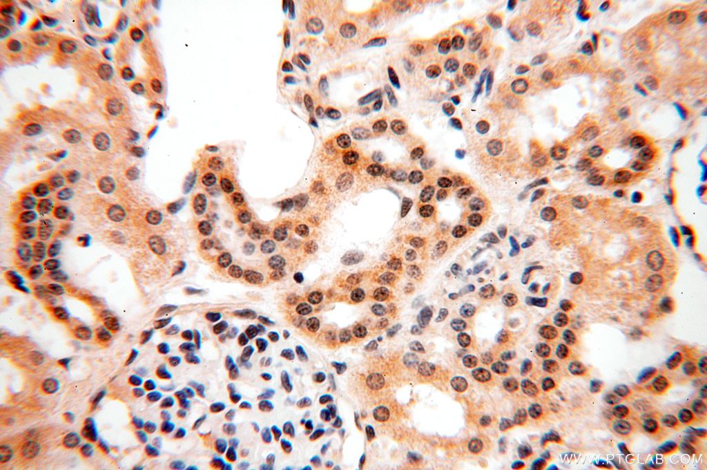 IHC staining of human kidney using 17639-1-AP