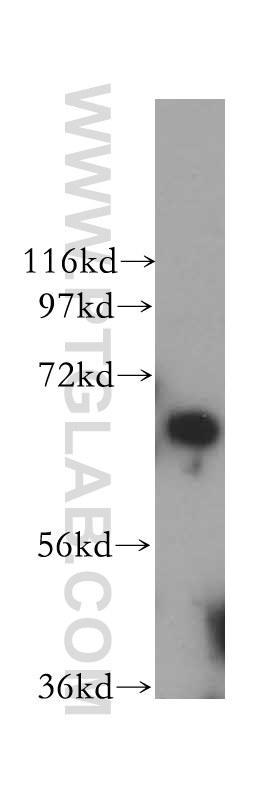 WB analysis of HeLa using 17639-1-AP