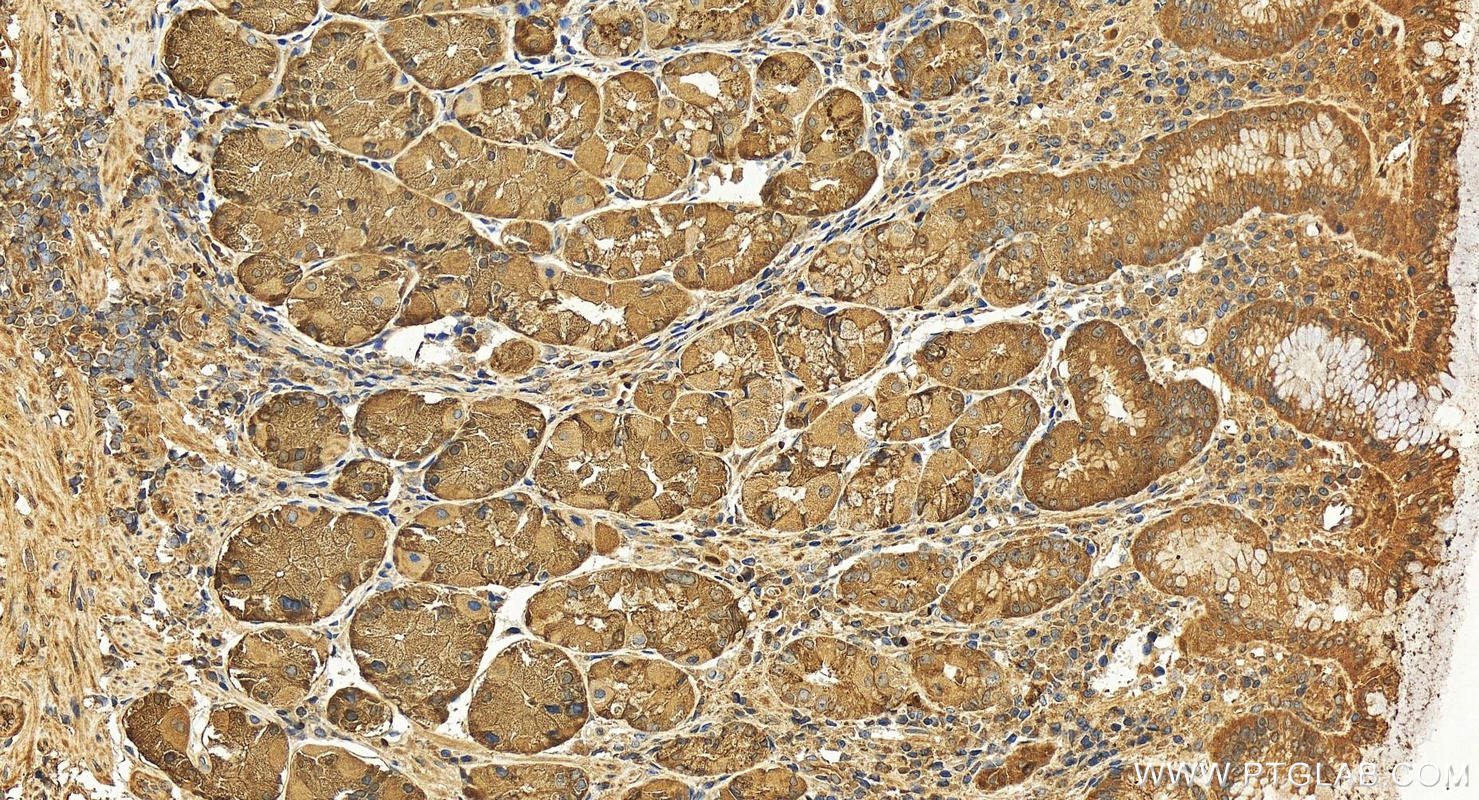 IHC staining of human stomach using 28532-1-AP