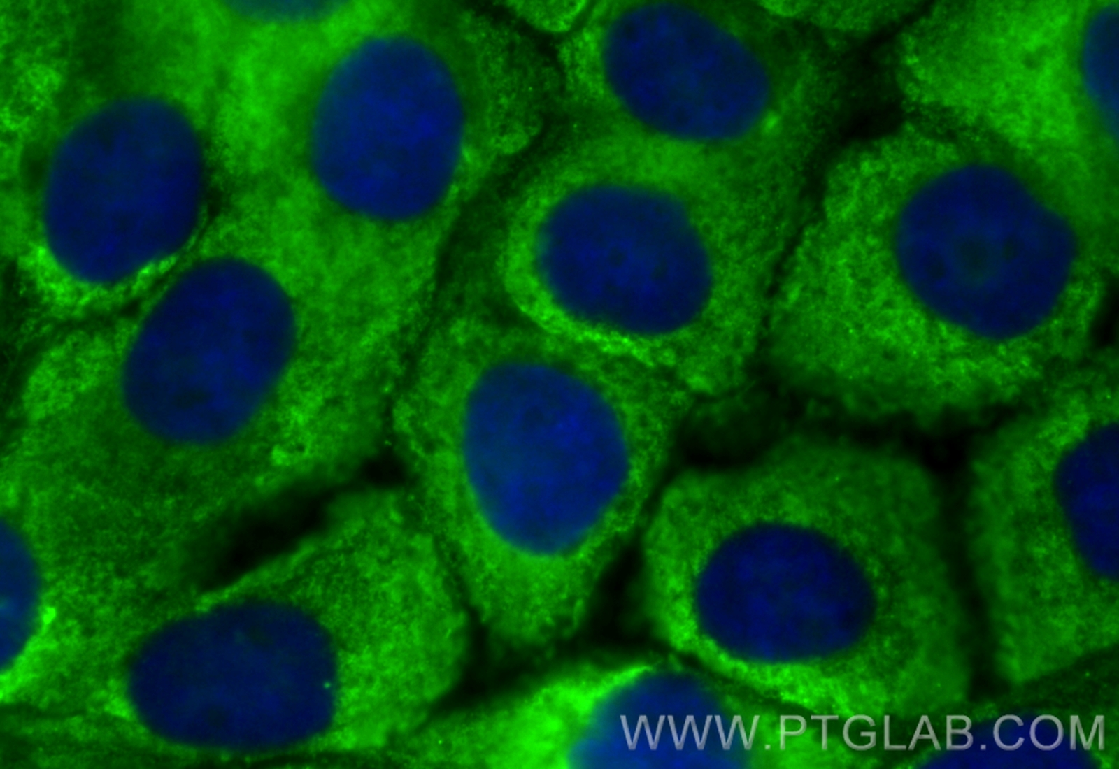 IF Staining of A431 using CL488-68035