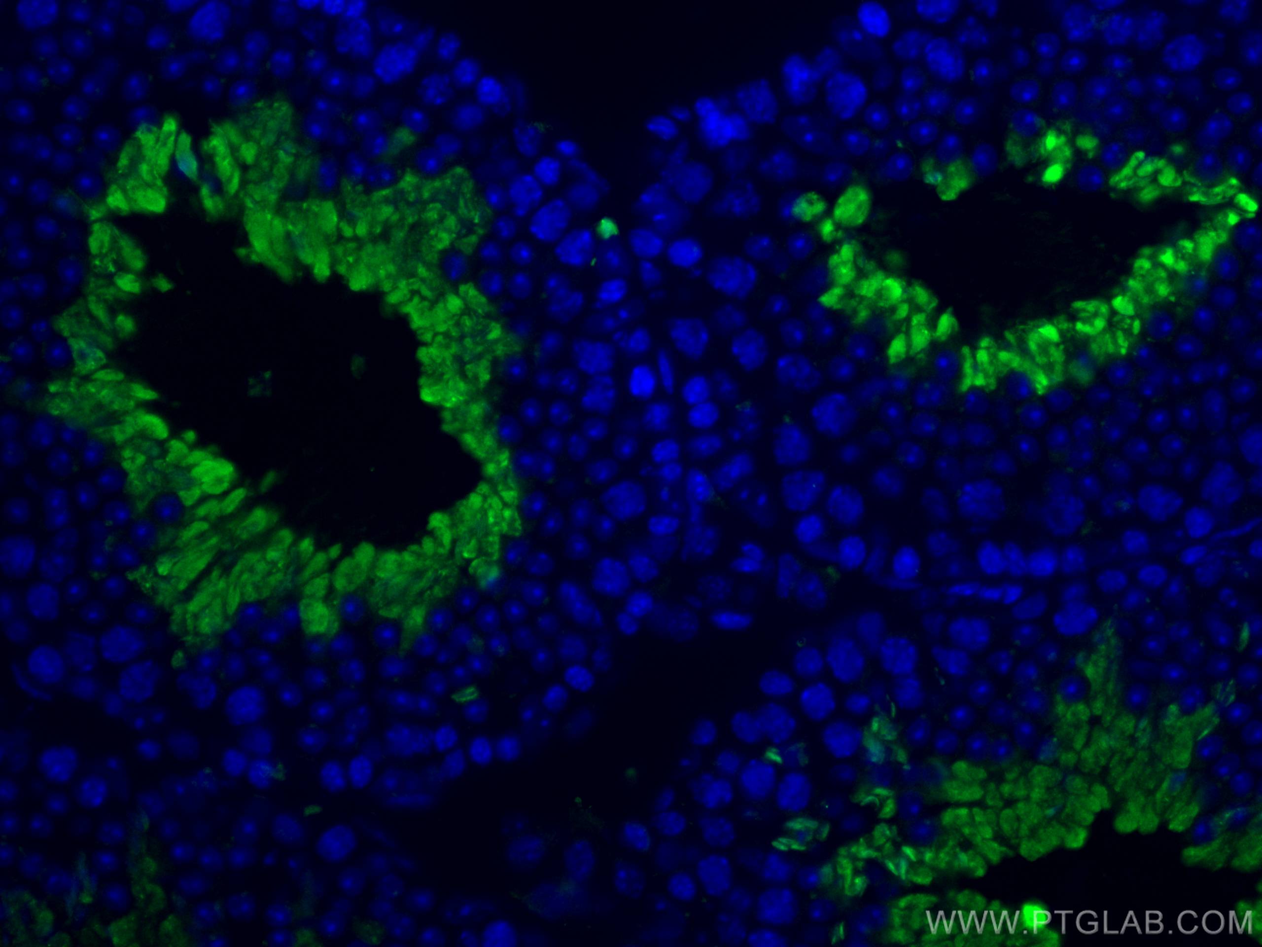 IF Staining of mouse testis using 13686-1-AP