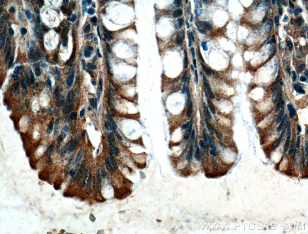 IHC staining of human colon using 66105-1-Ig (same clone as 66105-1-PBS)