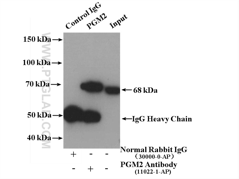 IP experiment of HEK-293 using 11022-1-AP